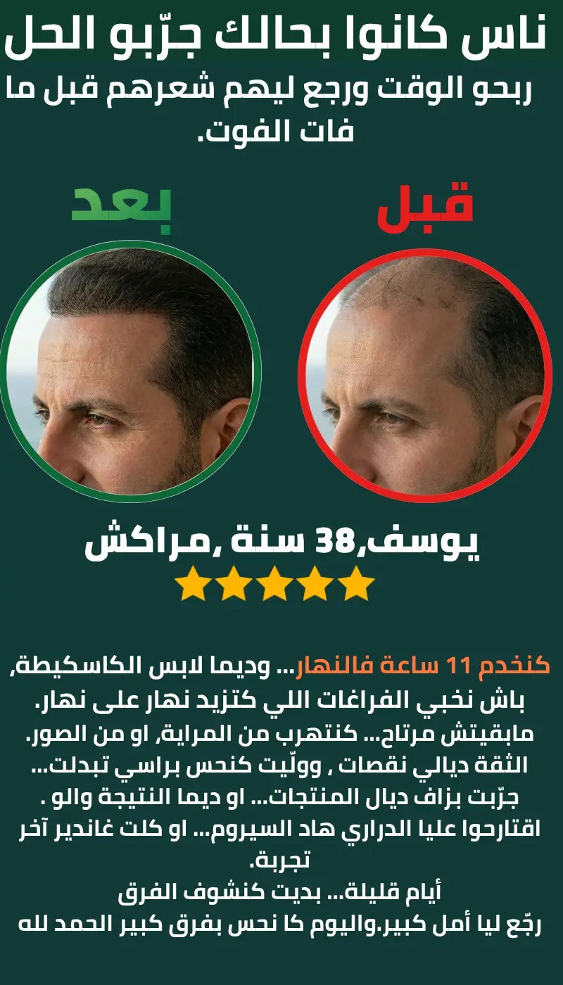 عروض Silavera ضد القشرة — شامبو وسيروم